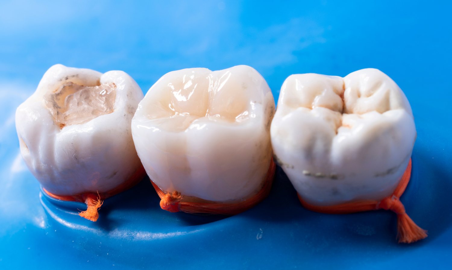 Preventive Care, Cleaning & Fillings treatment visual at Smiles for All Dental Clinic